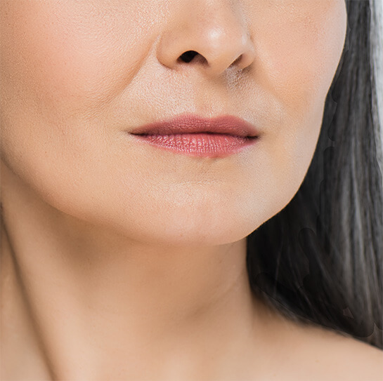 SAGGING FACIAL SKIN